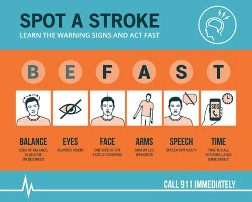 How to spot a stroke flyer