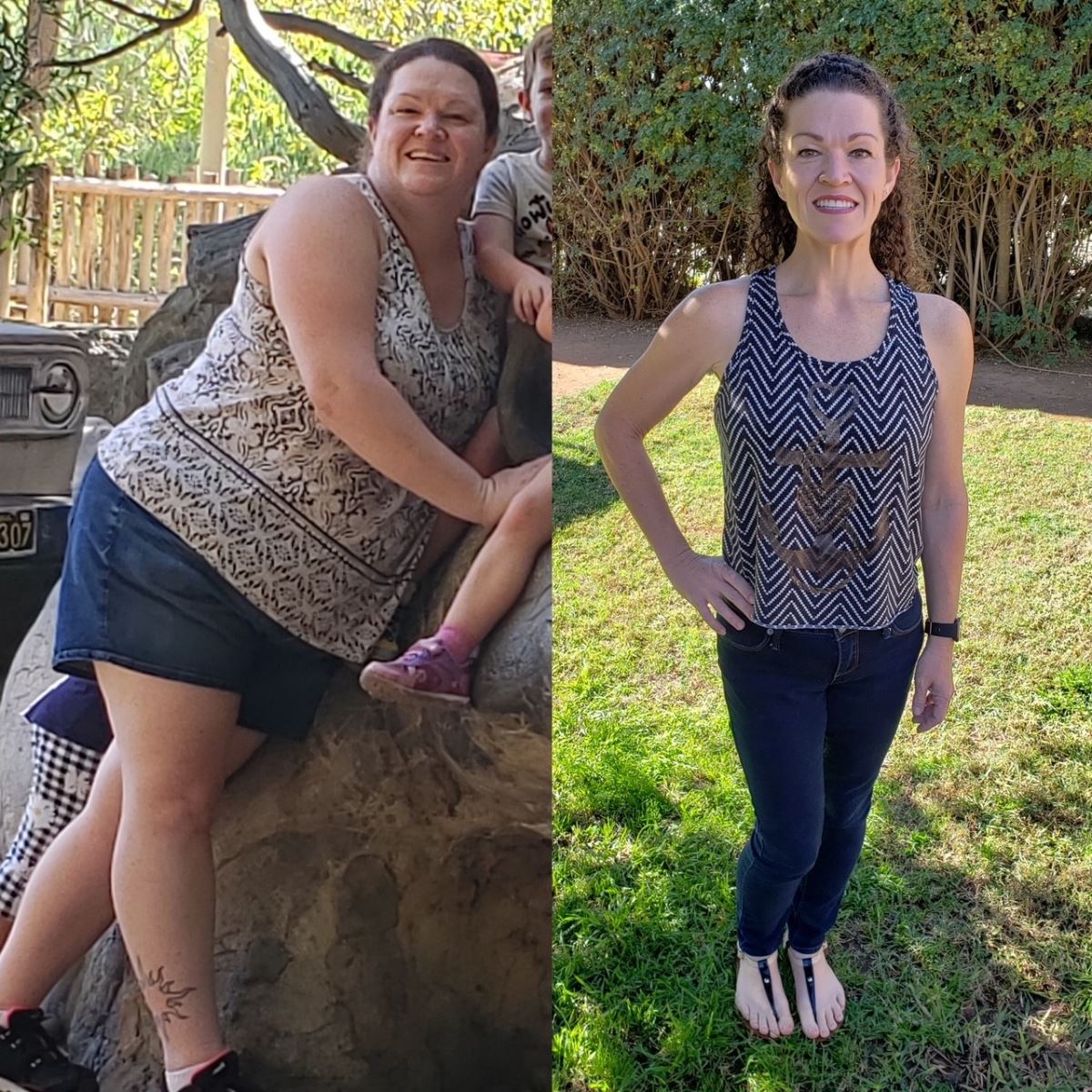 Bariatric Surgery Before and After Pictures